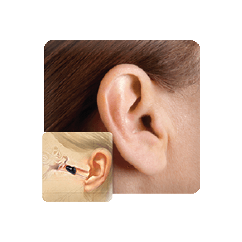 IIC Hearing aids