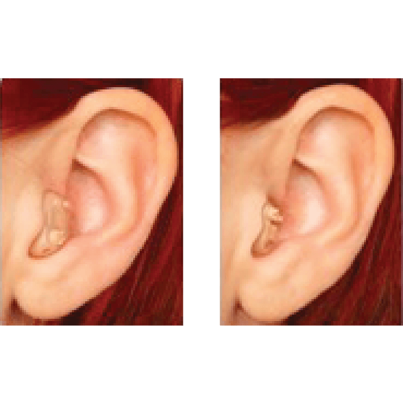 ITC/MC Hearing aids