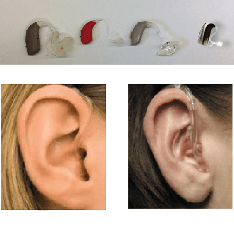 BTE Hearing aids