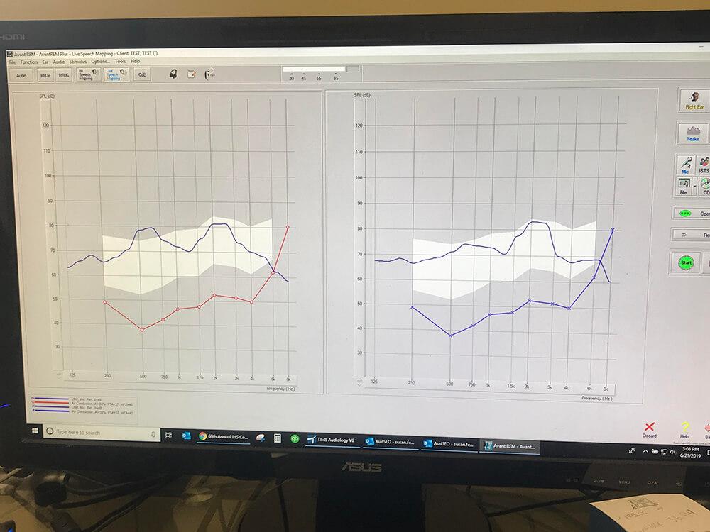 Live Speech Mapping