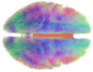 fuzzy brain scan